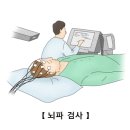 뇌전증 이미지