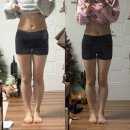 허벅지 복부 지방분해주사 가격 부작용 효과 3주차 후기(인데 먹방 파티인..ㅜ)