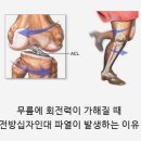 무릎통증 및 십자인대재활에 좋은 테이핑방법 배워요 [영상첨부] 이미지