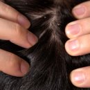 국가공인피부관리사자격대비 | 두피관리사자격증 학원 선택 꿀팁! 합격률 높은 곳 고르는 법