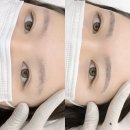 엔조브로우 | 포항눈썹문신 제거 걱정 없는곳 '엔조브로우'