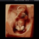 아름제일여성병원 이미지