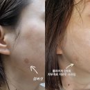 예담에스테틱 네이버블로그