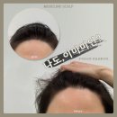 수헤어라인 이미지