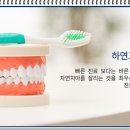 하얀고운치과의원 네이버블로그