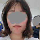 호박PC방 | 사랑니 4개 수면마취로 한꺼번에 발치한 후기