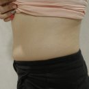 아이유 | 아이유주사 후기, 옷 핏이 달라졌다고 느낀 변화 과정