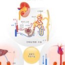 신장, 만성 / 급성 신부전증 및 (신장콩팥, 말기) 이미지