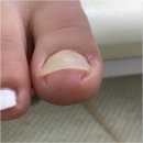 미엘네일닥터아이티엔범계지점