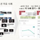 닥터K