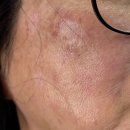 상무한의원 | 나의 오랜 숙원사업, 엄마 기미, 피부관리하기 1회차 후기 (ft. 상무지구/쌍촌동 한의원, 엄마돈엄마산)