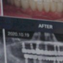 라이브치과기공소 이미지