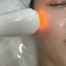 뷰티온다 | 인계동에스테틱 더마인뷰티에서 온다리프팅 후기, 한 번의 관리로 달라진 턱라인과 피부 탄력✨