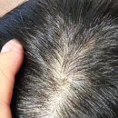 비오에너지 | 비오티아 탄산 앰플 후기 정수리 비침 고민에 사용해본 바르는 비오틴 두피케어