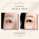아리뷰티 - 목포시 비파로51번길 27 | [용산·이태원·한남] 눈매 맞춤 속눈썹 전문 아리뷰티 방문 후기👀 지속력 최고!