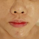 인계동 939 ~ 인계동 942-9 | 기미,잡티,홍조,모공레이져 결뷰티/인계동왁싱/인계동에체형관리/인계동피부관리/수원피부관리/수원웨딩...