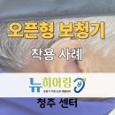 영운동 | 청주 영운동 보청기. 오픈형 보청기 착용 후기