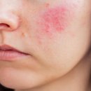 원 에스테틱 이미지