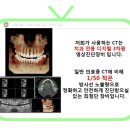 E-스타치과 네이버블로그