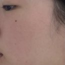 장피부과의원 | (내돈내산)나비존 모공 피부결 고민 솔직 후기 :: 청담피부과 청담리투의원 미라젯 쥬베룩 솔직 후기