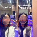 당신만의가치벨유의원 | 명동피부과 추천 요즘 핫한 온다리프팅 최고입니다,,