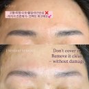채움Beauty | 흑채·팡팡이 말고, 단 1회로 정수리 숱채움 성공한 후기 (강남 두피커버)