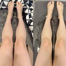 세븐일레븐 천안해피트리점 | 천안 바디관리 ｜ 샵토탈뷰티살롱 하체관리 리얼 후기