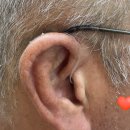 365보청기 이미지