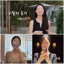 청담동성형외과 누운 귀필러 후기 효과 비용