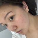 닷블레스유 | 주근깨 잡티걱정 끝 수원 피부관리 닷블레스유