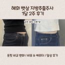 애프터 핏 | [혜화 뱃살 지방추출주사] 1달 2주 간의 변화 (옷핏 비교/ 비포&amp;애프터/일상 후기)