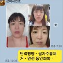 다운에이징자연성형연구소