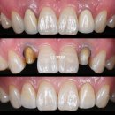 크라운독 이미지