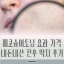 딱지 | 피코슈어토닝 효과 가격 내돈내산 피코토닝 3회 전후 딱지 후기