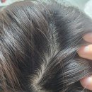 비타민나무의원 | 여성 탈모 영양제, 저도 고민 끝! 달라진 후기