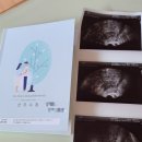 마리아산부인과의원 네이버블로그