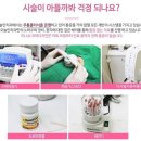 단기간에 치아 디자인을, 미니쉬 치아디자인! 이미지