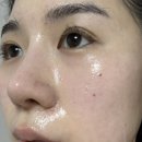 홍조당약국 | [제품리뷰] 약국화장품으로 홍조 잡는 홈케어 후기! EGF 필름 마스크팩