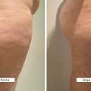 휴먼테카 이미지