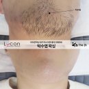 제이비라인 이미지