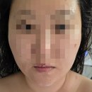 도림동 주민센터 내 | 신도림 윤곽관리 추천, 무이에스테틱 소프트 윤곽관리 추천 후기