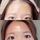 라임헤어 - 미추홀구 주염로28번길 39 | 산본왁싱 라임왁싱에서 이마/헤어라인, 뒷목 왁싱 후기