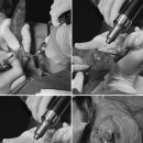 라온메디칼 이미지