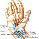 손목 터널 증후군 이미지