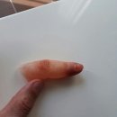 바른의수족제작연구소 이미지