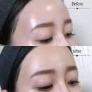 기나건강 | 슈퍼젝션 홈키트 파격할인 정보 내돈내산 모공관리 사용법 후기