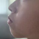 행복한치과의원 | <용인 기흥 소아치과추천> ♥︎아이가 행복한치과♥︎에서 초등학생 악궁 확장기 솔직 후기 / 치열변화 전후...
