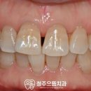 청주으뜸치과의원 이미지