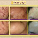 해율한의원 네이버블로그
