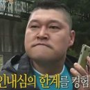 고려정성의원 | 밴스모자이너의원 여자헤어라인모발이식 솔직후기ㅣ비어보이는 머리 채우기 성공 ✨